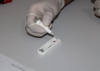 Óbidos registra 15 novos casos de HIV e é o segundo no ranking estadual com mais casos da doença